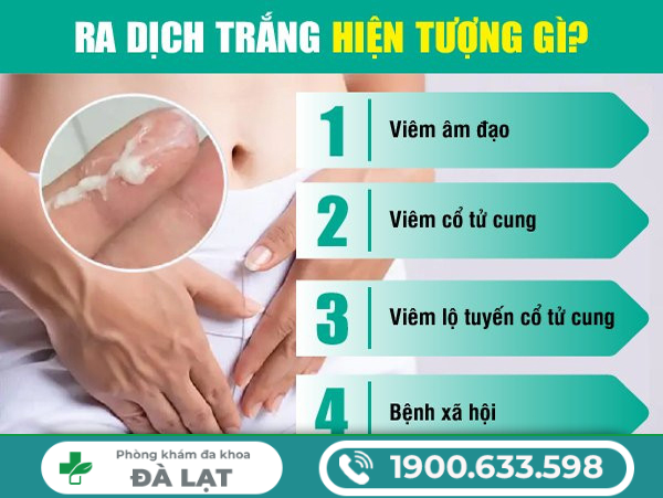 Hình ảnh minh họa